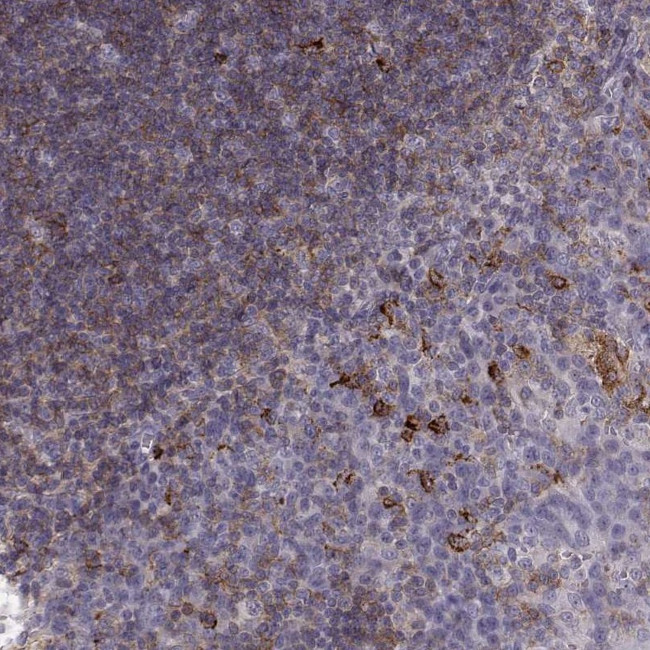 Cyclin F Antibody in Immunohistochemistry (IHC)