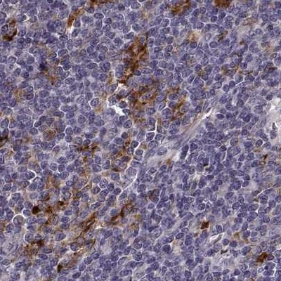 Cyclin F Antibody in Immunohistochemistry (IHC)