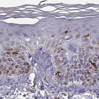 Cyclin F Antibody in Immunohistochemistry (IHC)