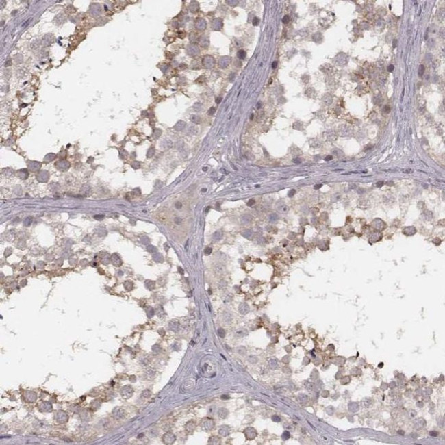 FAM13B Antibody in Immunohistochemistry (IHC)