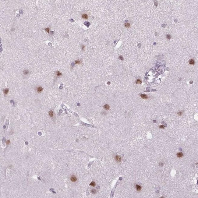 MAGEB3 Antibody in Immunohistochemistry (IHC)