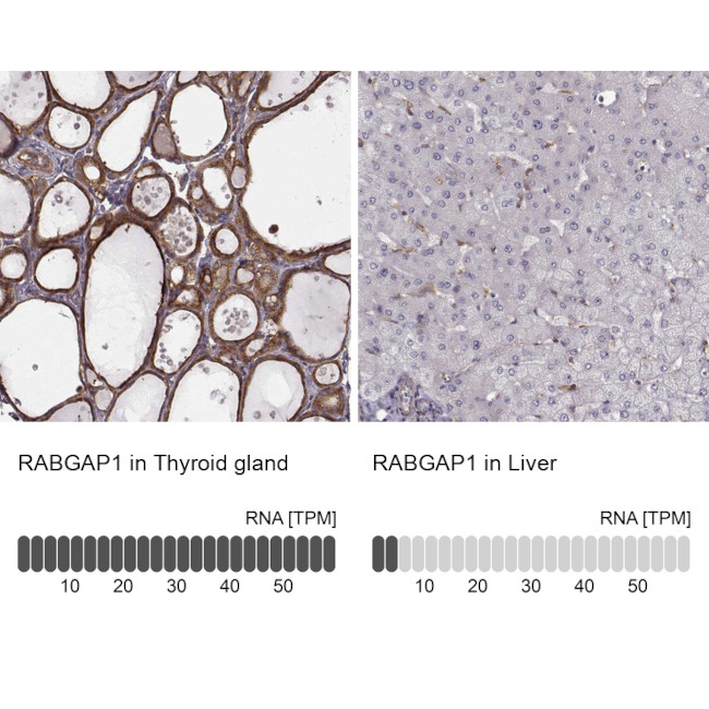 RABGAP1 Antibody in Immunohistochemistry (IHC)