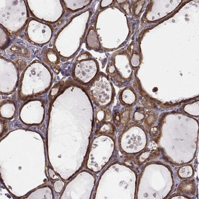 RABGAP1 Antibody in Immunohistochemistry (IHC)