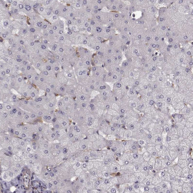 RABGAP1 Antibody in Immunohistochemistry (IHC)