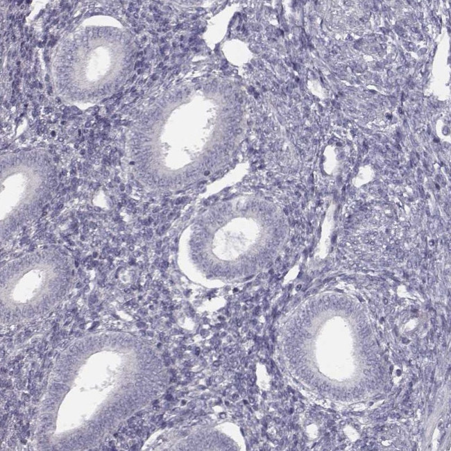 Septin-14 Antibody in Immunohistochemistry (IHC)