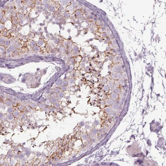 Septin-14 Antibody in Immunohistochemistry (IHC)