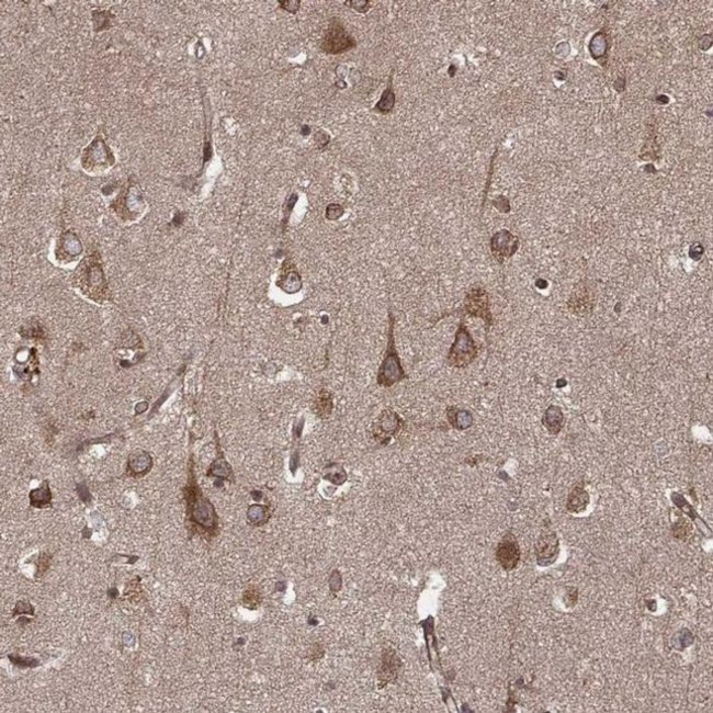 AGPAT1 Antibody in Immunohistochemistry (IHC)