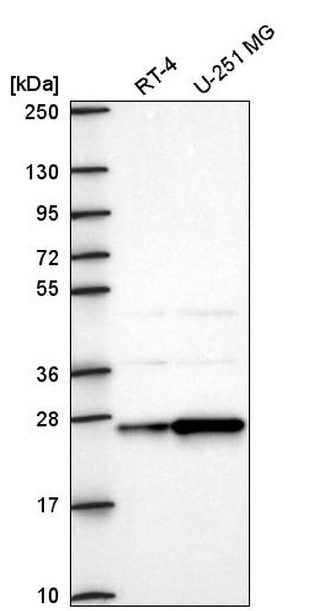 AGPAT1 Antibody in Western Blot (WB)