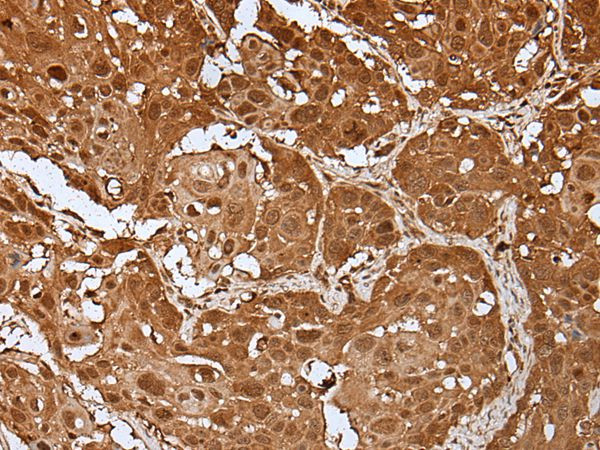 UBE1L Antibody in Immunohistochemistry (Paraffin) (IHC (P))