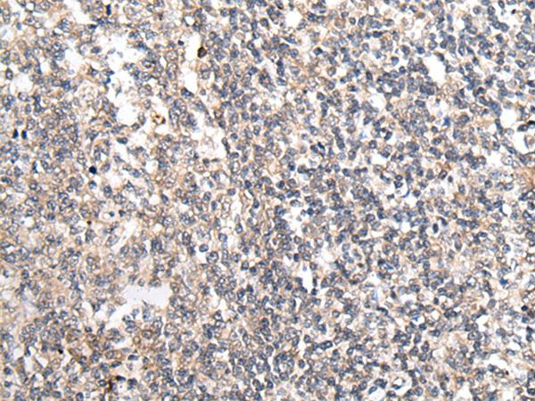 MT-ND5 Antibody in Immunohistochemistry (Paraffin) (IHC (P))