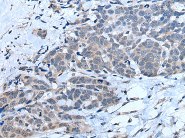 MTHFR Antibody in Immunohistochemistry (Paraffin) (IHC (P))