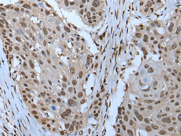 ZNHIT3 Antibody in Immunohistochemistry (Paraffin) (IHC (P))