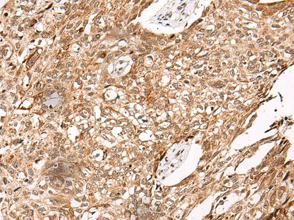 NO66 Antibody in Immunohistochemistry (Paraffin) (IHC (P))