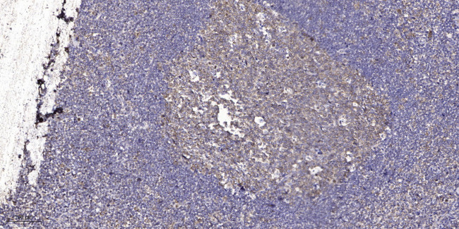 ASF1B Antibody in Immunohistochemistry (Paraffin) (IHC (P))