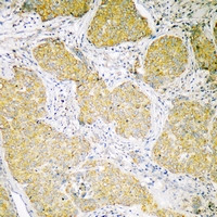 MCU Antibody in Immunohistochemistry (Paraffin) (IHC (P))