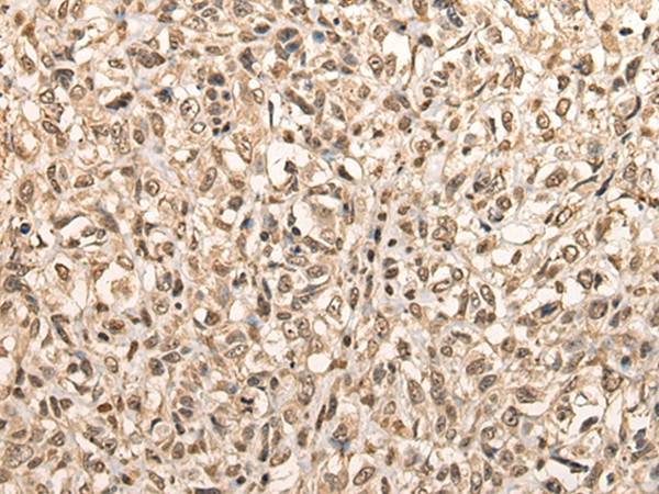 BarX1 Antibody in Immunohistochemistry (Paraffin) (IHC (P))