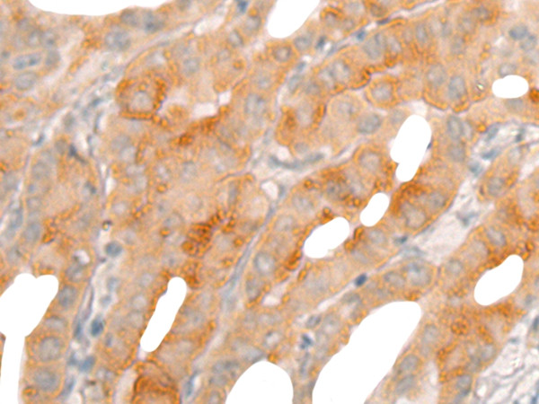 BBOX1 Antibody in Immunohistochemistry (Paraffin) (IHC (P))