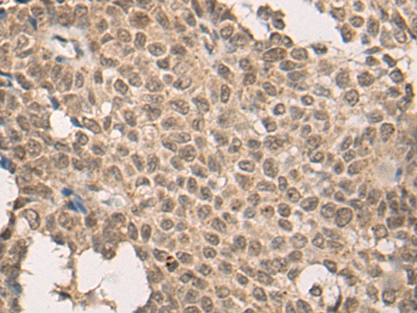 BRD8 Antibody in Immunohistochemistry (Paraffin) (IHC (P))