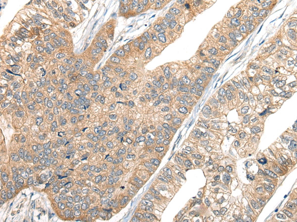 CA7 Antibody in Immunohistochemistry (Paraffin) (IHC (P))