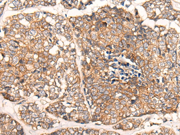 CACNA2D2 Antibody in Immunohistochemistry (Paraffin) (IHC (P))