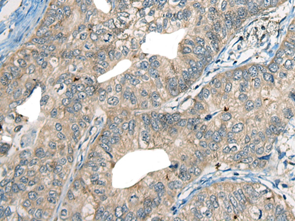 CDADC1 Antibody in Immunohistochemistry (Paraffin) (IHC (P))