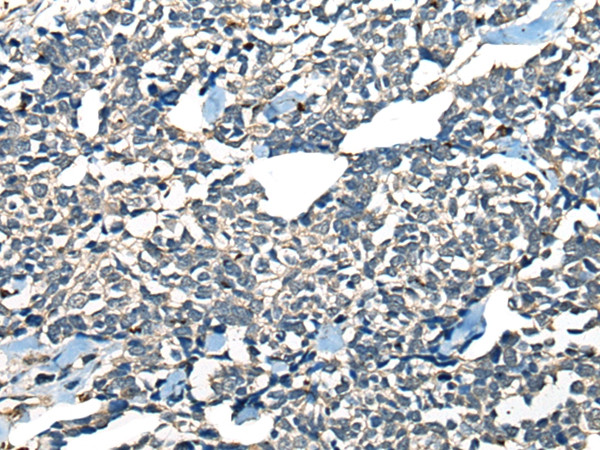 CDADC1 Antibody in Immunohistochemistry (Paraffin) (IHC (P))