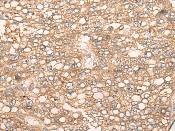 SLC5A8 Antibody in Immunohistochemistry (Paraffin) (IHC (P))