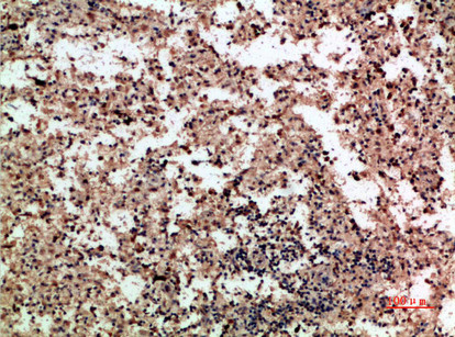 PF4 Antibody in Immunohistochemistry (Paraffin) (IHC (P))