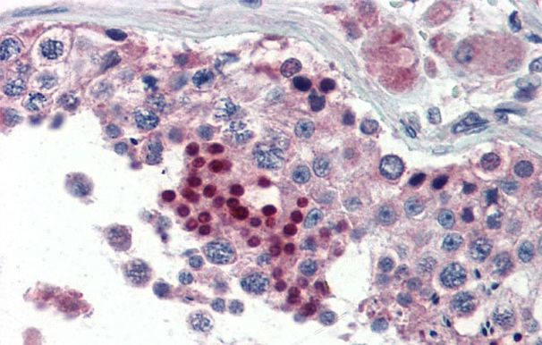 NR0B1 Antibody in Immunohistochemistry (IHC)