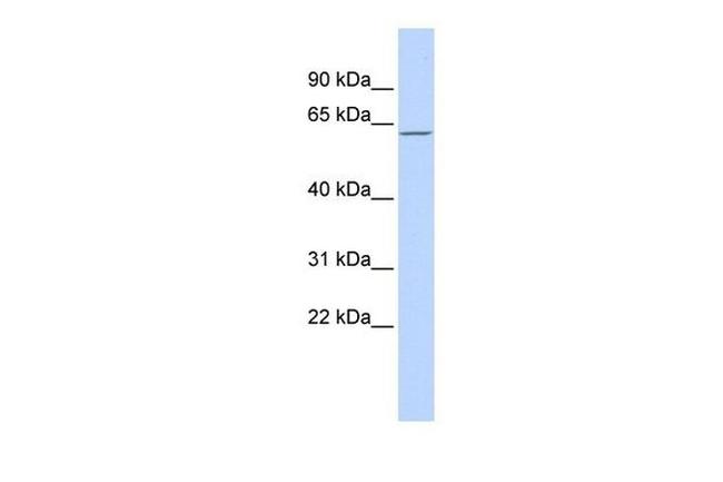 MBD4 Antibody in Western Blot (WB)