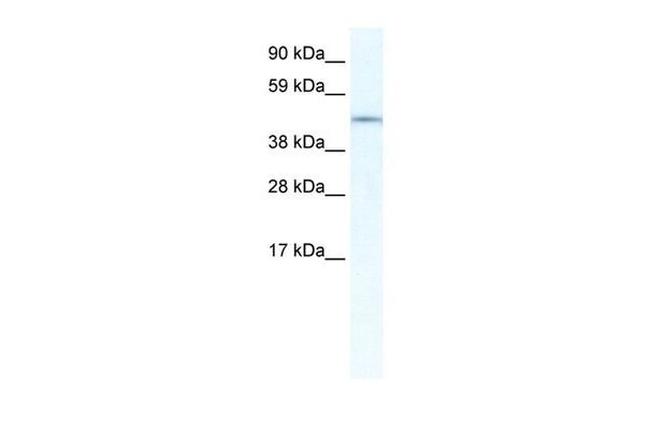 IRX3 Antibody in Western Blot (WB)