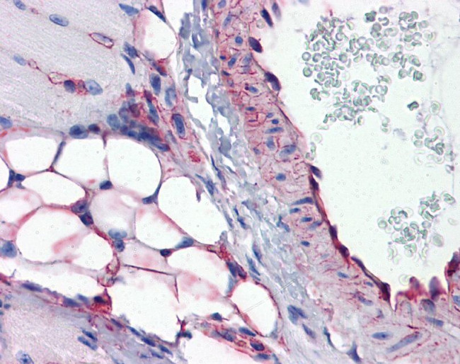 PTRF Antibody in Immunohistochemistry (Paraffin) (IHC (P))