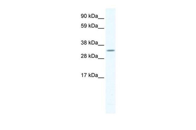 APE1 Antibody in Western Blot (WB)