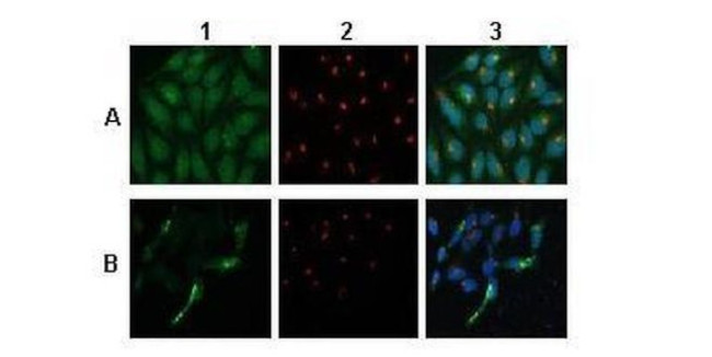 ATP6V0A1 Antibody in Immunocytochemistry (ICC/IF)