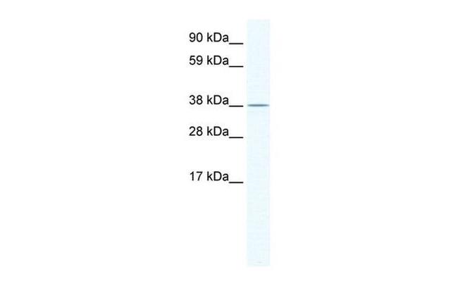 MRI1 Antibody in Western Blot (WB)