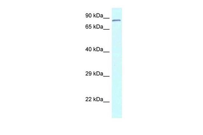 CNOT3 Antibody in Western Blot (WB)