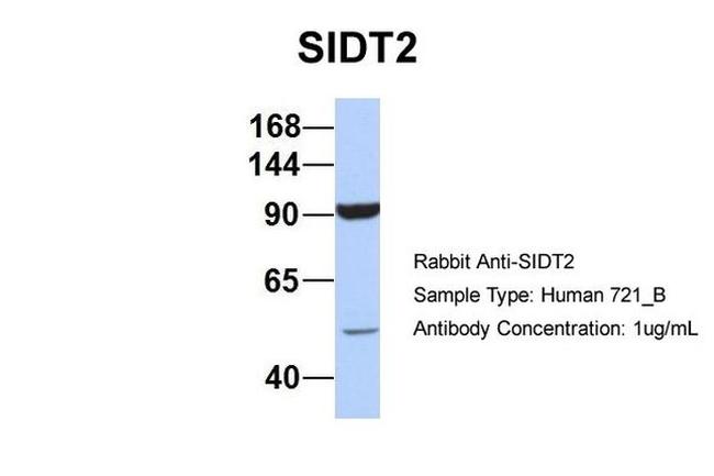 SIDT2 Antibody in Western Blot (WB)