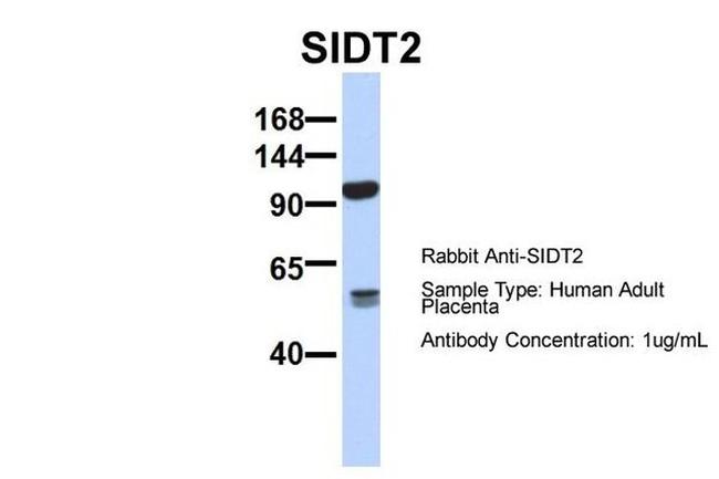 SIDT2 Antibody in Western Blot (WB)