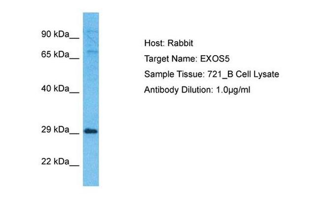 EXOSC5 Antibody in Western Blot (WB)