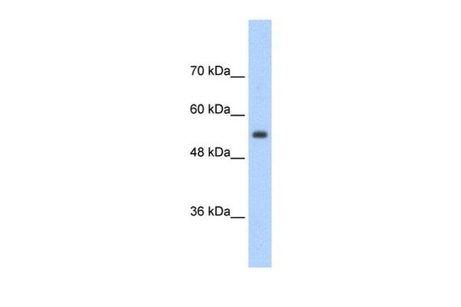 SLC13A3 Antibody in Western Blot (WB)