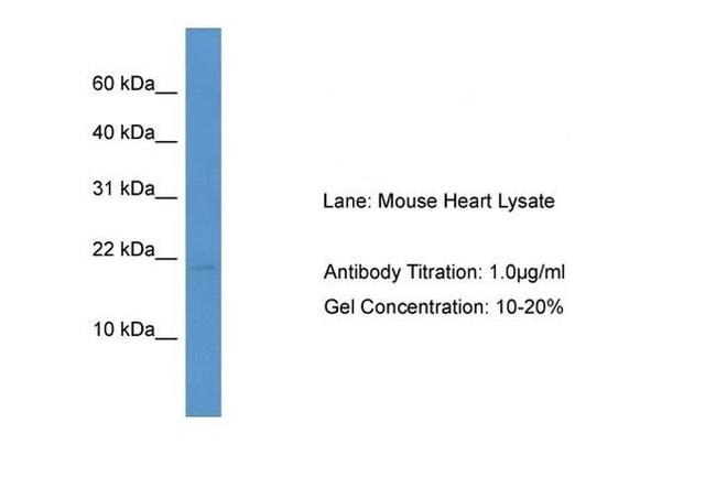 HSPB7 Antibody in Western Blot (WB)