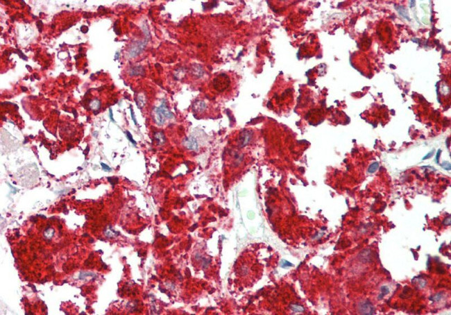 RAPGEF2 Antibody in Immunohistochemistry (Paraffin) (IHC (P))