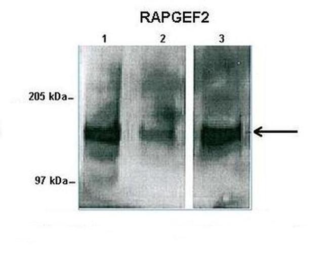 RAPGEF2 Antibody in Western Blot (WB)