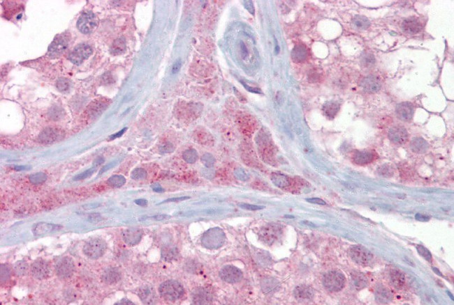 UBE2L3 Antibody in Immunohistochemistry (IHC)