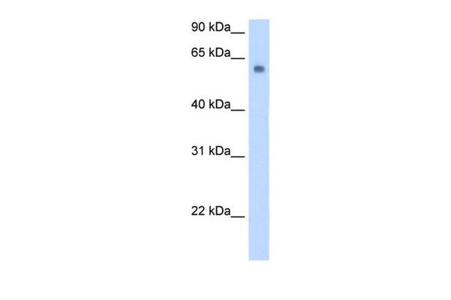 SLC1A4 Antibody in Western Blot (WB)