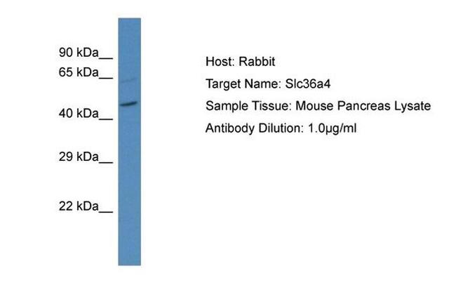 SLC36A4 Antibody in Western Blot (WB)