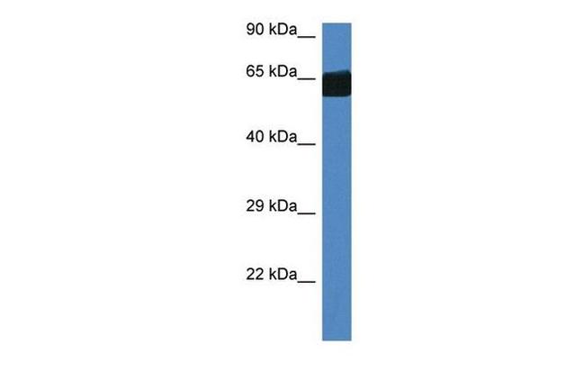 FMO3 Antibody in Western Blot (WB)