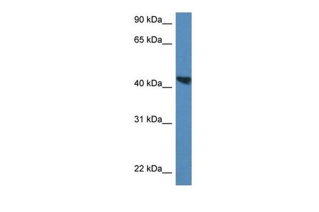 MEIS3 Antibody in Western Blot (WB)