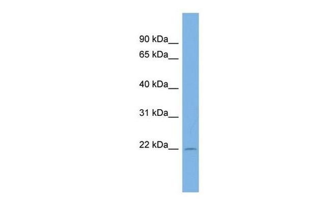 C13orf28 Antibody in Western Blot (WB)