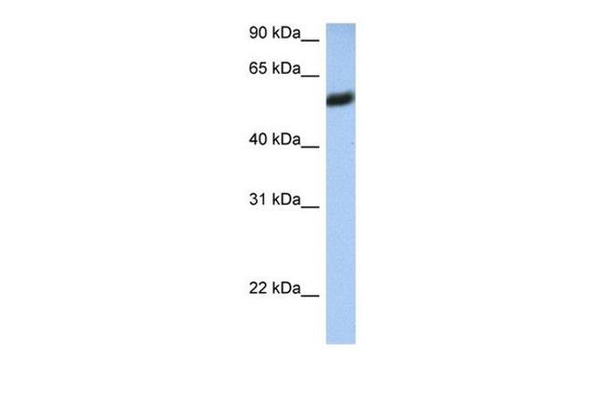 HLA-F Antibody in Western Blot (WB)